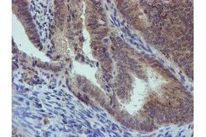 Image no. 8 for anti-Phosphoglucomutase 3 (PGM3) antibody (ABIN1500178)