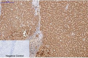 Immunohistochemical analysis of paraffin-embedded human liver tissue. (HSV Tag antibody)