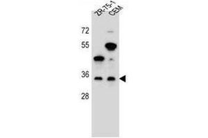 GPM6B Antibody (N-term) western blot analysis in ZR-75-1,CEM cell line lysates (35µg/lane).