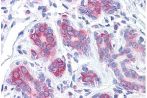 Human Breast: Formalin-Fixed, Paraffin-Embedded (FFPE) (RPS2 antibody  (AA 198-294))