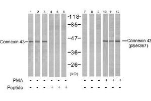 Image no. 2 for anti-Gap Junction Protein, alpha 1, 43kDa (GJA1) (pSer367), (pSer368) antibody (ABIN197018)