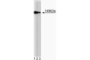 Western blot analysis of AKAP149 on a HeLa cell lysate (Human cervical epitheloid carcinoma, ATCC CCL-2.