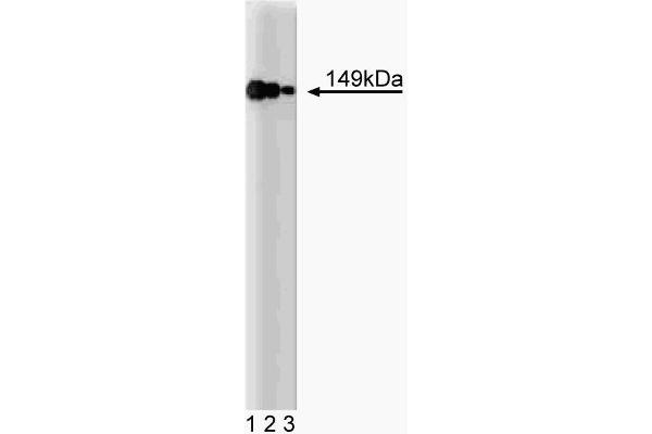 AKAP1 anticorps  (AA 66-212)