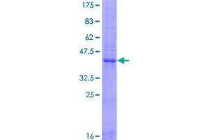 Image no. 1 for Epididymal Protein 3A (EDDM3A) (AA 1-147) protein (GST tag) (ABIN1353457) (Epididymal Protein 3A (EDDM3A) (AA 1-147) protein (GST tag))