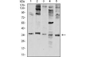 Western Blotting (WB) image for anti-Elastase, Neutrophil Expressed (ELANE) (AA 140-267) antibody (ABIN5611332)