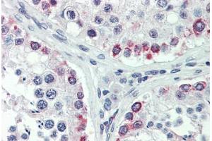 Human Testis: Formalin-Fixed, Paraffin-Embedded (FFPE) (HDAC2 antibody  (N-Term))