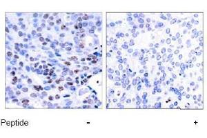 Image no. 1 for anti-Nuclear Factor of kappa Light Polypeptide Gene Enhancer in B-Cells 1 (NFKB1) (Ser337) antibody (ABIN197123) (NFKB1 antibody  (Ser337))