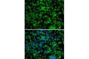 Immunofluorescence analysis of A-549 cells using PHYHD1 antibody (ABIN6133210, ABIN6145585, ABIN6145586 and ABIN6223037). (PHYHD1 antibody  (AA 1-291))