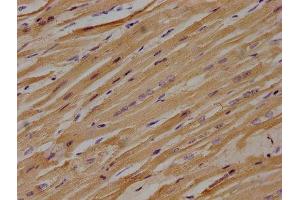 IHC image of ABIN7139912 diluted at 1:100 and staining in paraffin-embedded human heart tissue performed on a Leica BondTM system. (LPAR3 antibody  (AA 312-330))