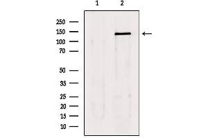 Western blot analysis of extracts from 293, using lats1/2 Antibody. (LATS1 antibody  (Internal Region))