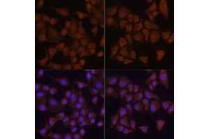 Immunofluorescence analysis of HeLa cells using MAP1LC3B antibody. (LC3B antibody)