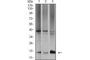 Western blot analysis using SAG2 mouse mAb against SW480 (1), A431 (2), and K562 (3) cell lysate. (Surface Antigen 2B antibody  (AA 1-130))