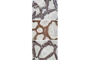 Immunohistochemistry staining of mouse mammary gland samples from lactating mice (L10) with Eif2ak3 polyclonal antibody . (PERK antibody  (AA 601-1115))