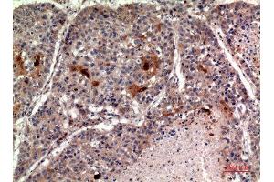 Immunohistochemistry (IHC) analysis of paraffin-embedded Human Lung, antibody was diluted at 1:100. (RANKL antibody  (C-Term))