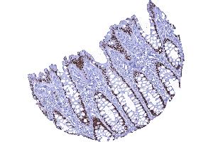 A strong nuclear SATB2 immunostaining is seen in all epithelial cells of the normal colorectal mucosa (Recombinant SATB2 antibody  (AA 200-300))