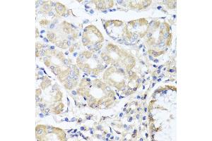 Immunohistochemistry of paraffin-embedded human stomach using OPA3 antibody (ABIN5975243) at dilution of 1/100 (40x lens). (OPA3 antibody)