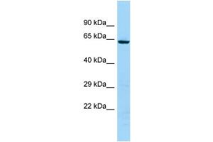 WB Suggested Anti-KRT74 Antibody Titration: 1. (KRT74 antibody  (C-Term))
