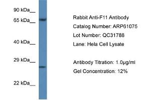 Western Blotting (WB) image for anti-Coagulation Factor XI (F11) (C-Term) antibody (ABIN2788664) (Factor XI antibody  (C-Term))