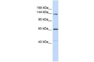 PCDH12 antibody used at 1 ug/ml to detect target protein. (PCDH12 antibody  (Middle Region))