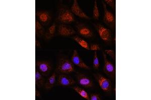Immunofluorescence analysis of NIH/3T3 cells using ZC3H12D Rabbit pAb (ABIN7271448) at dilution of 1:100. (ZC3H12D antibody  (AA 150-230))