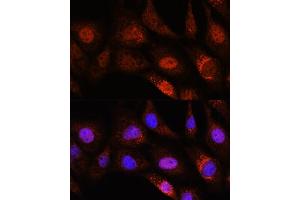Immunofluorescence analysis of NIH/3T3 cells using ZC3H12D Rabbit pAb (ABIN7271448) at dilution of 1:100. (ZC3H12D antibody  (AA 150-230))
