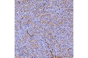 IHC analysis of SNRNP200 using anti-SNRNP200 antibody (ABIN7602032). (SNRNP200 antibody  (AA 557-2129))