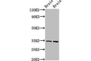 Western Blot Positive WB detected in: Mouse brain tissue, Rat brain tissue All lanes: FOXE3 antibody at 4 μg/mL Secondary Goat polyclonal to rabbit IgG at 1/50000 dilution Predicted band size: 34 kDa Observed band size: 34 kDa (FOXE3 antibody  (AA 4-74))