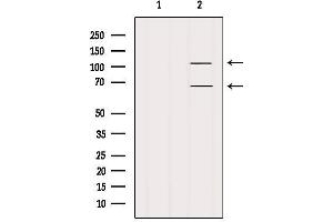 Western blot analysis of extracts from Mouse lung, using FAM65B Antibody. (FAM65B antibody)