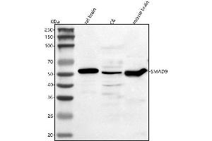 Western blot analysis of Smad9 using anti-Smad9 antibody (ABIN7600133).