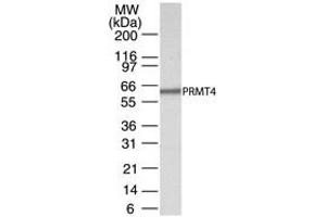Western Blotting (WB) image for anti-Coactivator-Associated Arginine Methyltransferase 1 (CARM1) (AA 45-69) antibody (ABIN208355) (CARM1 antibody  (AA 45-69))
