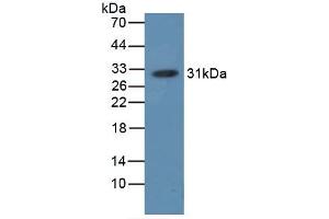 Detection of HB in HB, Simian using Polyclonal Antibody to Hemoglobin (HB) (Hemoglobin antibody)