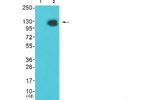 Western blot analysis of extracts from HeLa cells and JurKat cells, using HDAC4 (Ab-632) antibody. (HDAC4 antibody  (Ser632))