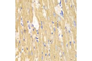Immunohistochemistry of paraffin-embedded mouse heart using CAPN1 antibody at dilution of 1:100 (400x lens).