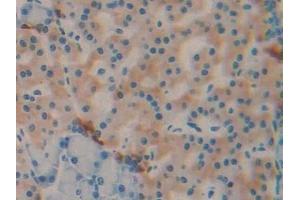 Detection of DBP in Rat Pancreas Tissue using Monoclonal Antibody to Vitamin D Binding Protein (DBP) (Vitamin D-Binding Protein antibody  (AA 209-394))
