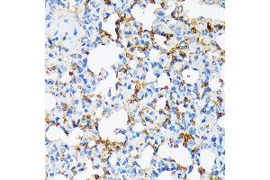 Immunohistochemistry of paraffin-embedded rat lung using Alpha-2-Macroglobulin (Alpha-2-Macroglobulin (M)) Rabbit mAb (ABIN7265558) at dilution of 1:100 (40x lens). (alpha 2 Macroglobulin antibody)