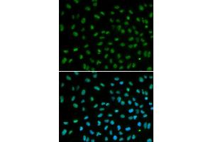 Immunofluorescence analysis of MCF7 cell using DDB2 antibody. (DDB2 antibody)