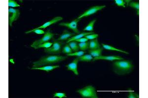 Immunofluorescence of purified MaxPab antibody to GUCA1C on HeLa cell. (GUCA1C antibody  (AA 1-209))