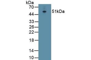 Detection of Recombinant ATP1a1, Rabbit using Polyclonal Antibody to ATPase, Na+/K+ Transporting Alpha 1 Polypeptide (ATP1a1) (ATP1A1 antibody  (AA 339-772))