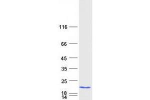 Family with Sequence Similarity 32, Member A (FAM32A) protein (Myc-DYKDDDDK Tag)