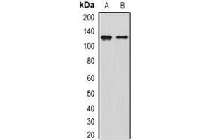 Western blot analysis of SIRT1 expression in Jurkat (A), MCF7 (B) whole cell lysates. (SIRT1 antibody)