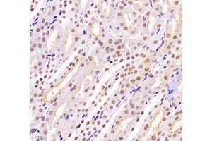 Immunohistochemistry of paraffin embedded mouse kidney using MECOM (ABIN7074575) at dilution of 1: 2200 (400x lens)