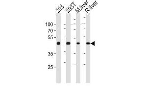 Western Blotting (WB) image for anti-Ornithine Aminotransferase (OAT) antibody (ABIN3003953) (OAT antibody)