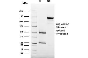 SDS-PAGE Analysis Purified CD35 Mouse Monoclonal Antibody (SPM554).