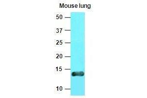 The extracts of mouse lung tissue(40 ug) were resolved by SDS-PAGE, transferred to nitrocellulose membrane and probed with anti-human Cellubrevin (1:1000). (VAMP3 antibody  (AA 1-77))