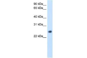 GGTLA4 antibody used at 5 ug/ml to detect target protein. (GGTLC1 antibody  (C-Term))