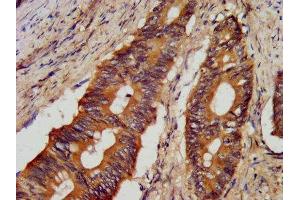 Junctophilin 1 antibody  (AA 431-546)
