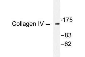 Image no. 1 for anti-Collagen, Type IV (COL4) antibody (ABIN265367) (Collagen IV antibody)
