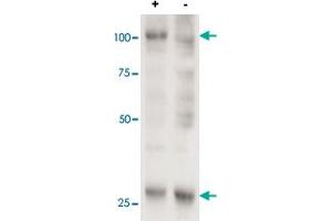 Cell line 143B overexpressing human AARS2 and probed with AARS2 polyclonal antibody  (mock transfection in second lane). (AARS2 antibody  (AA 478-489))