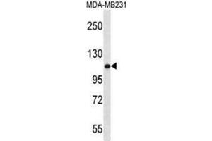 ACTN3 Antibody (Center) western blot analysis in MDA-MB231 cell line lysates (35µg/lane). (ACTN3 antibody  (Middle Region))