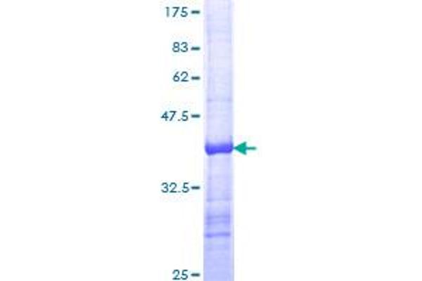 ODZ1/Teneurin 1 Protein (AA 2616-2725) (GST tag)